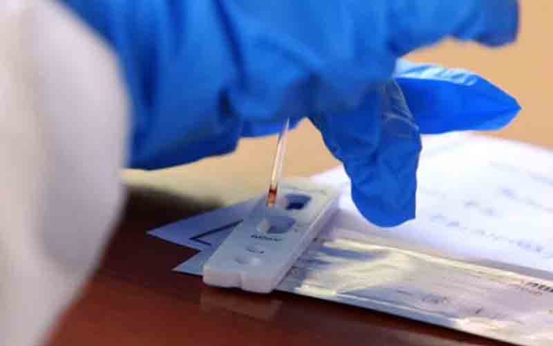 Polda Amakan Penumpang di Bandara Depati Amir, Diduga Pakai PCR Palsu